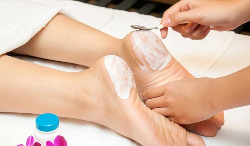 Vaseline Chữa da bị nứt, nẻ