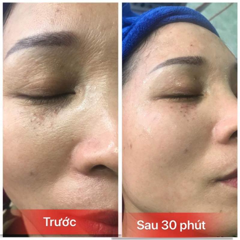 Thẩm Mỹ Quốc Tế Emmy