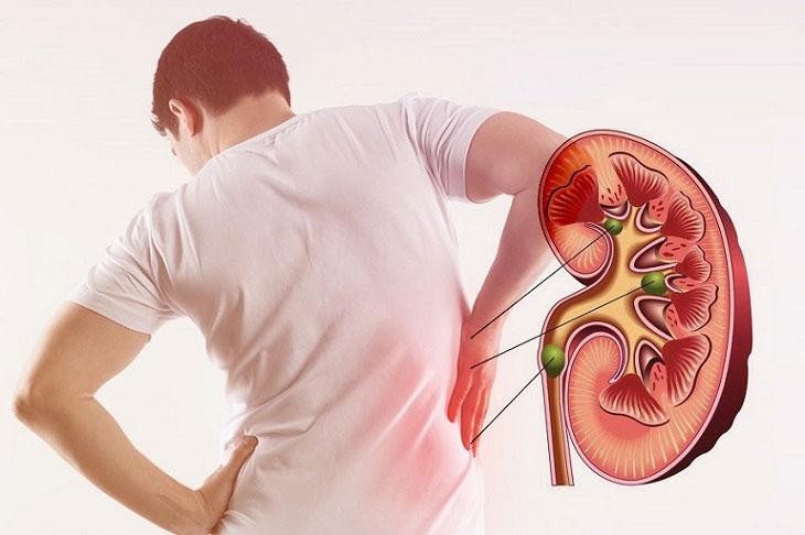 Đối với bệnh nhân suy thận: Cần giảm liều dùng