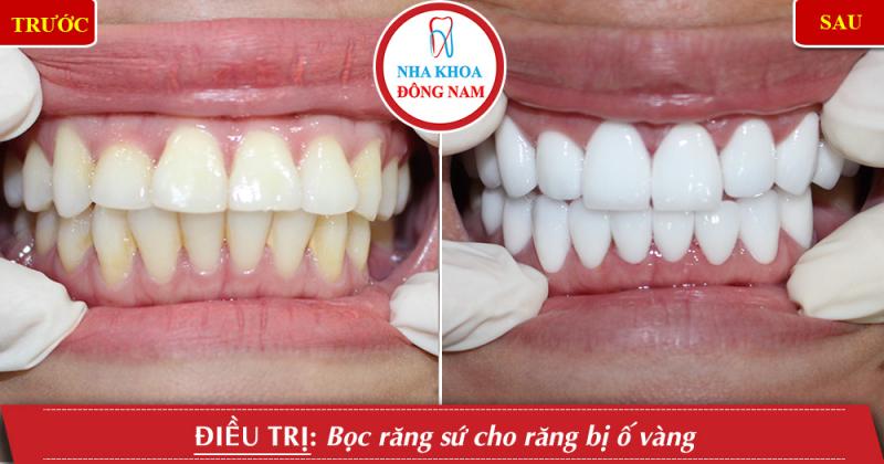 NHA KHOA ĐÔNG NAM