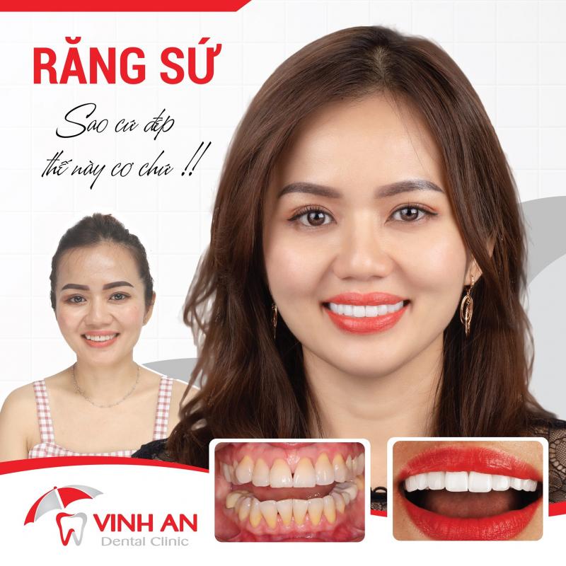 Nha Khoa Vinh An