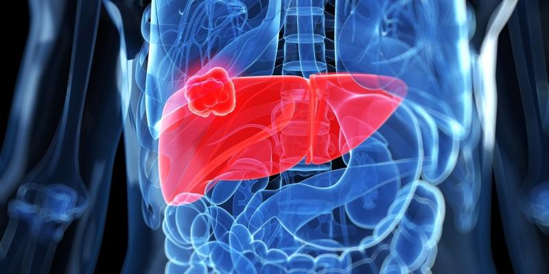 Tỏi có tác dụng phòng ngừa cũng như hỗ trợ điều trị ung thư dạ dày, ung thư gan,...