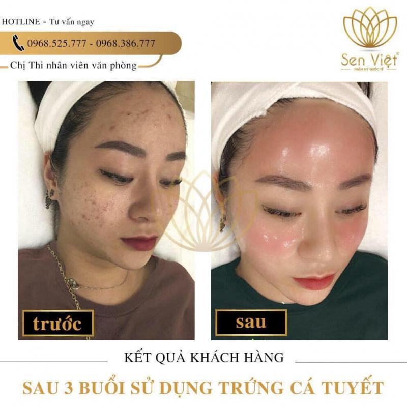 Thẩm Mỹ Quốc Tế Sen Việt