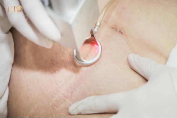 Thẩm mỹ Rio Beauty Clinic