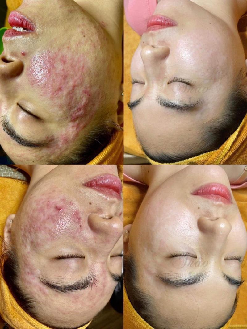 Thảo Spa